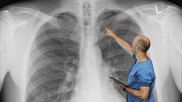 Is Your Breathing Holding You Back? Discover a Natural Way to Support Lung Health
